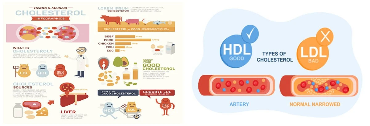 HDL & LDL HDL & LDL